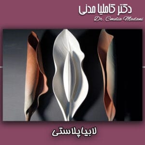 لابیاپلاستی - دکتر کاملیا مدنی