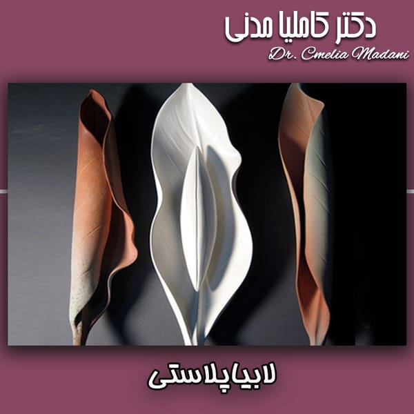 لابیاپلاستی - دکتر کاملیا مدنی