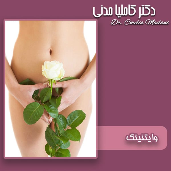 وایتنینگ - دکتر کاملیا مدنی