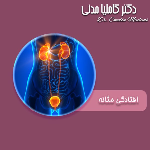 افتادگی مثانه - دکتر کاملیا مدنی