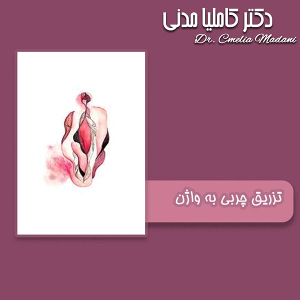 تزریق چربی به واژن - دکتر کاملیا مدنی