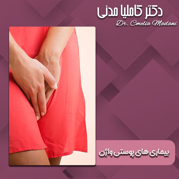 بیماری های پوستی واژن - دکتر کاملیا مدنی