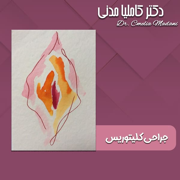جراحی کلیتوریس - دکتر کاملیا مدنی