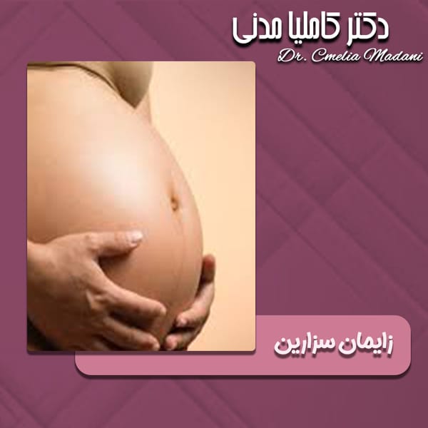 زایمان سزارین - دکتر کاملیا مدنی