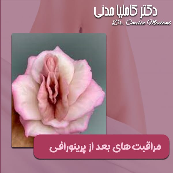 مراقبت های بعد از پرینورافی - دکتر مدنی