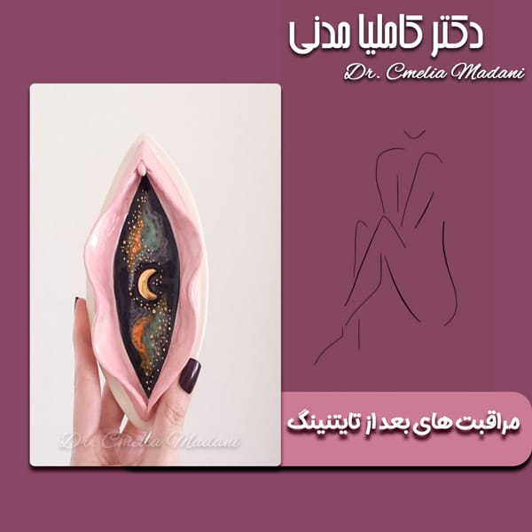 مراقبت های بعد از تایتنینگ - دکتر کاملیا مدنی
