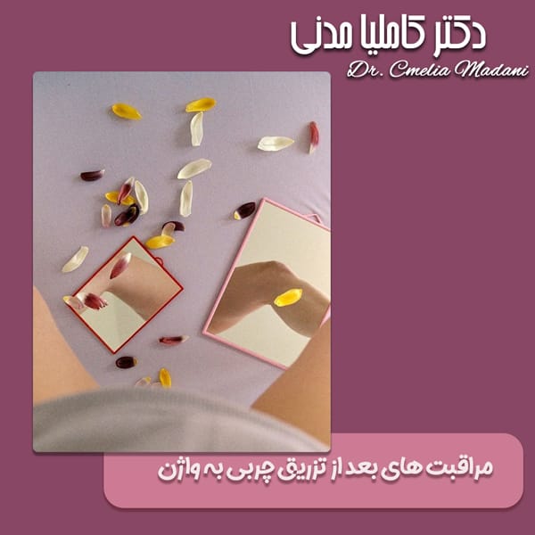 مراقبت های بعد از تزریق چربی به واژن - دکتر کاملیا مدنی