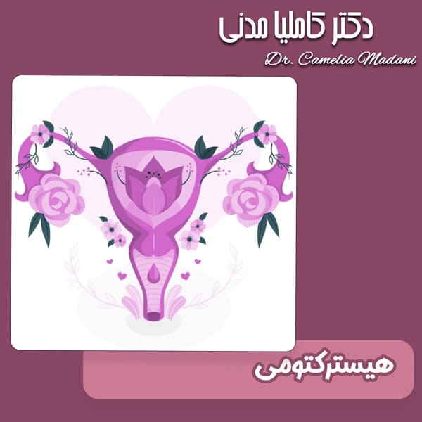 هیسترکتومی - دکتر کاملیا مدنی