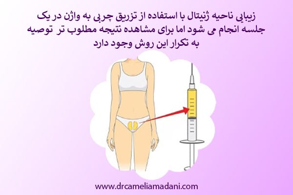 تزریق چربی به واژن _ دکتر کاملیا مدنی