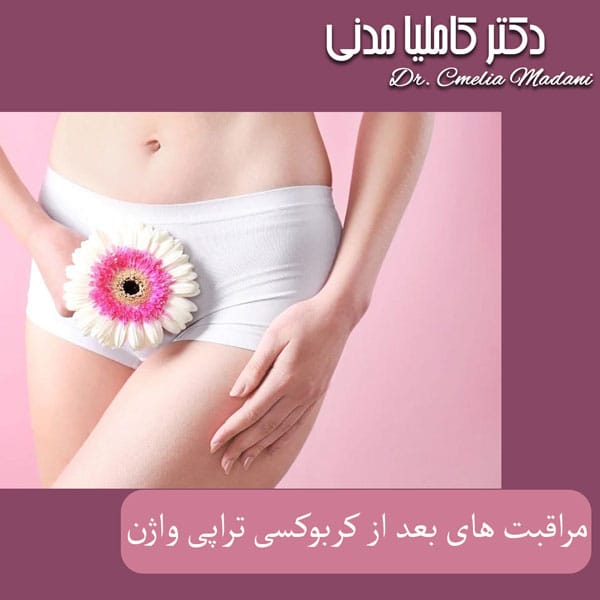 مراقبت های بعد از کربوکسی تراپی واژن - دکتر کاملیا مدنی