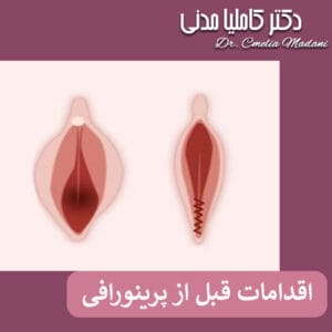 اقدامات قبل از پرینورافی - دکتر کاملیا مدنی