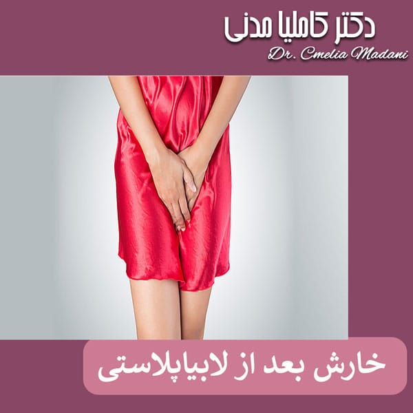 خارش بعد از لابیاپلاستی - دکتر کاملیا مدنی