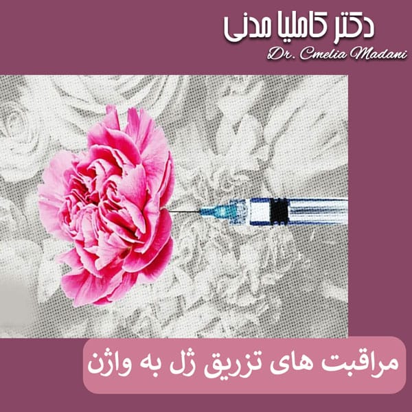 مراقبت های بعد از تزریق ژل به واژن - دکتر کاملیا مدنی