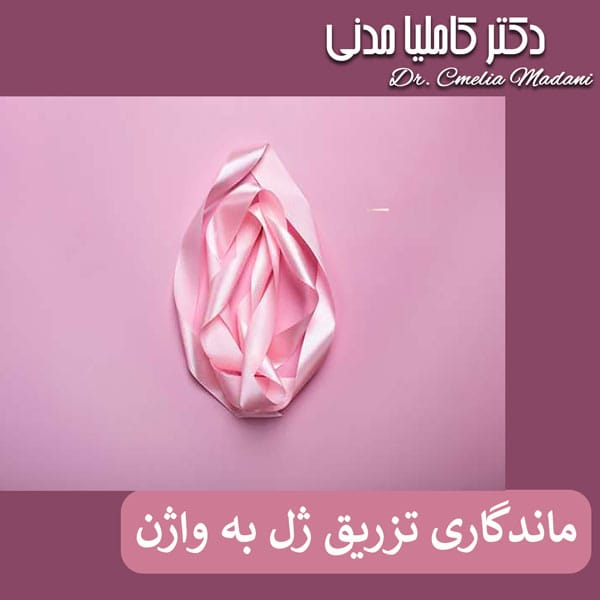 ماندگاری تزریق ژل به واژن _ دکتر کاملیا مدنی