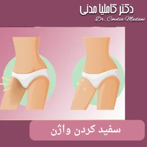 واژینال وایتنینگ _ دکتر کاملیا مدنی