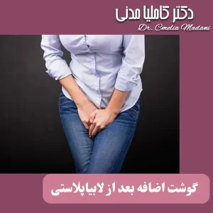 گوشت اضافه بعد از لابیاپلاستی _ دکتر کاملیا مدنی