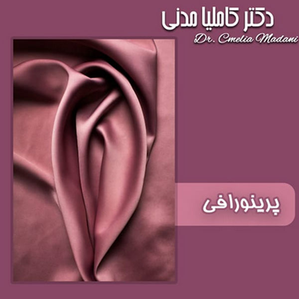 پرینورافی