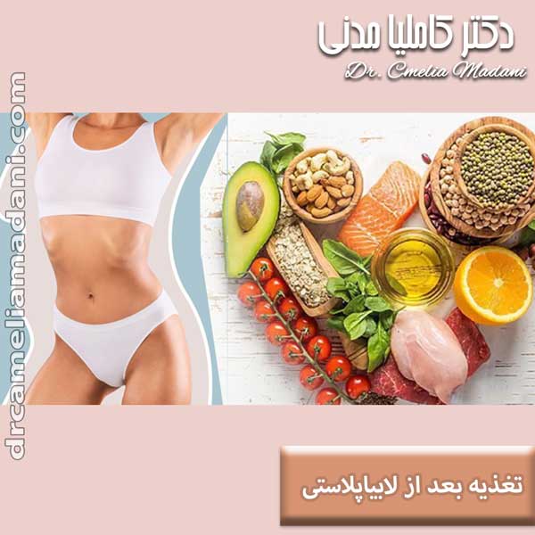 تغذیه بعد از لابیاپلاستی - دکتر کاملیا مدنی