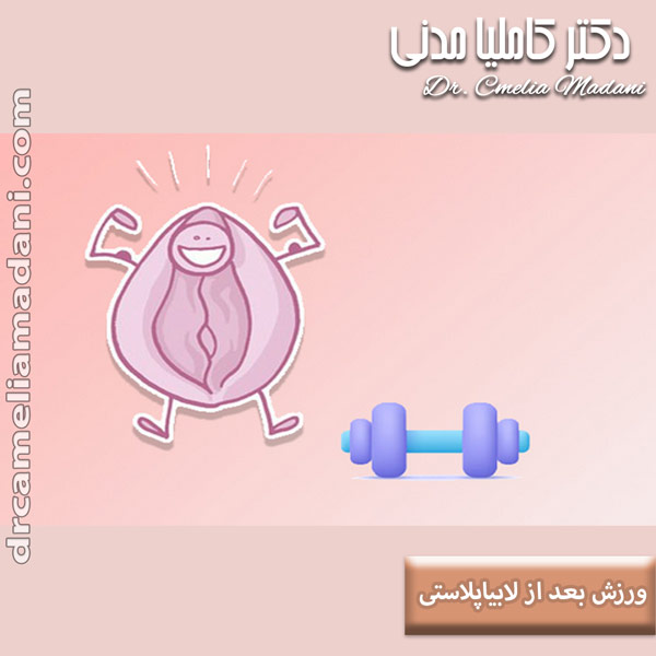 ورزش بعد از لابیاپلاستی - دکتر کاملیا مدنی