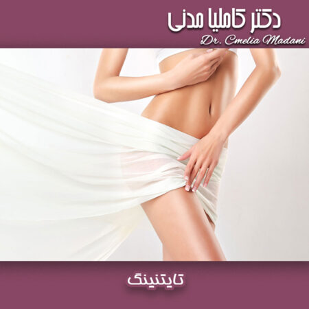 تایتنینگ - دکتر کاملیا مدنی